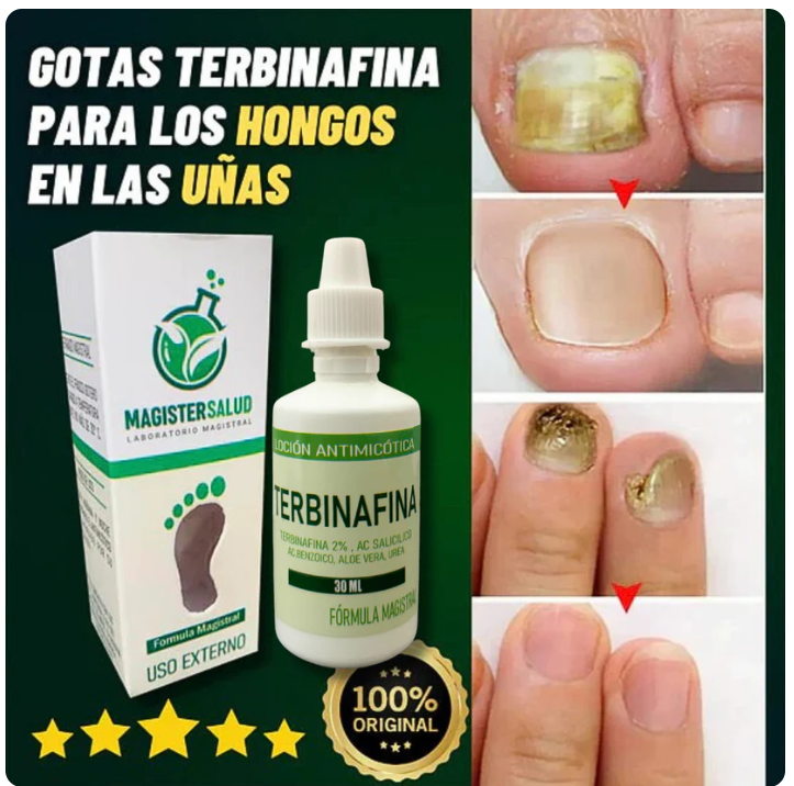 TERBINAFINA - GOTAS PARA HONGOS DE UÑAS